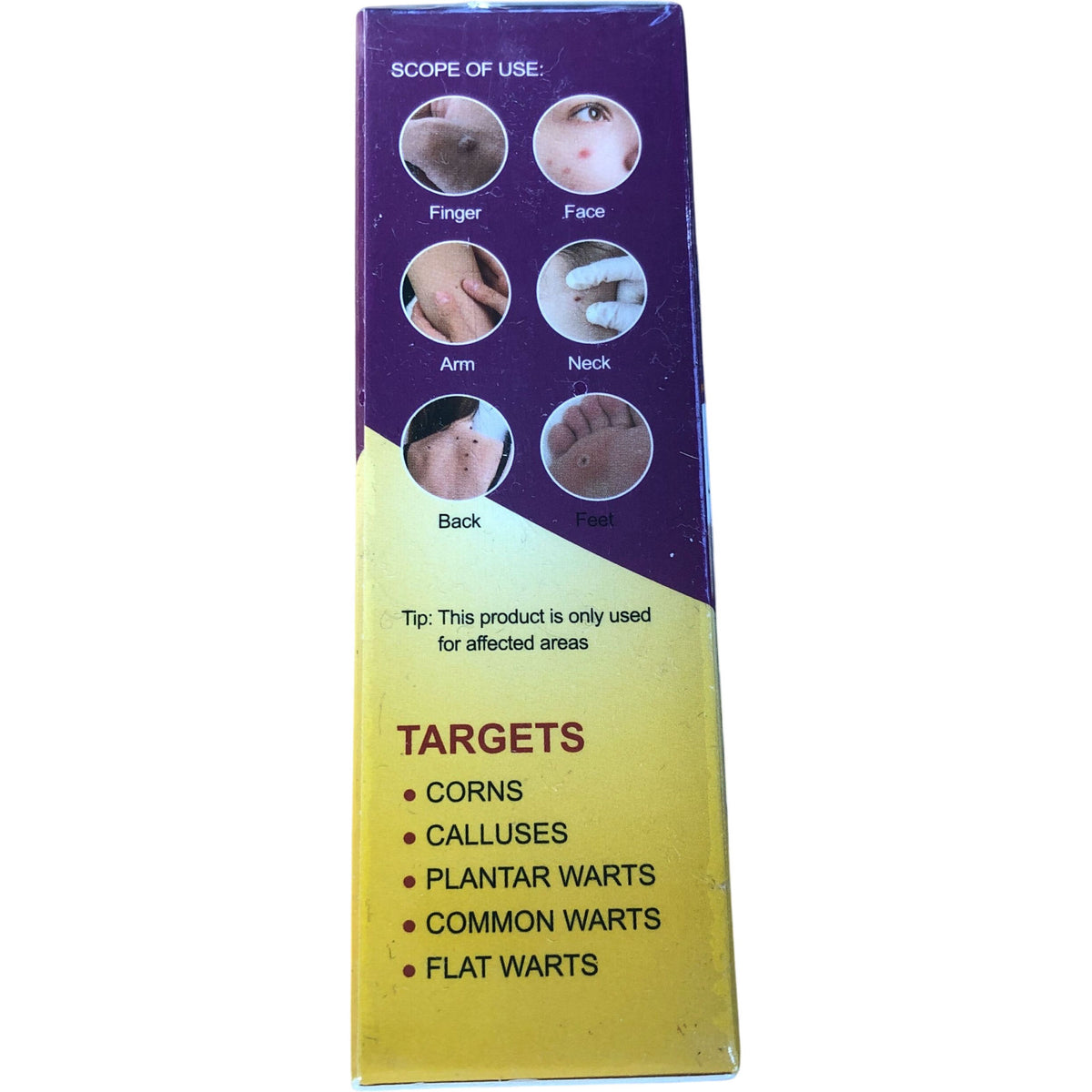 Bee Venom Skin Tag Remover 30ml Fast Results Easy To Use Wart Treatment