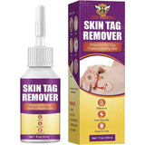 Bee Venom Skin Tag Remover 30ml Fast Results Easy To Use Wart Treatment