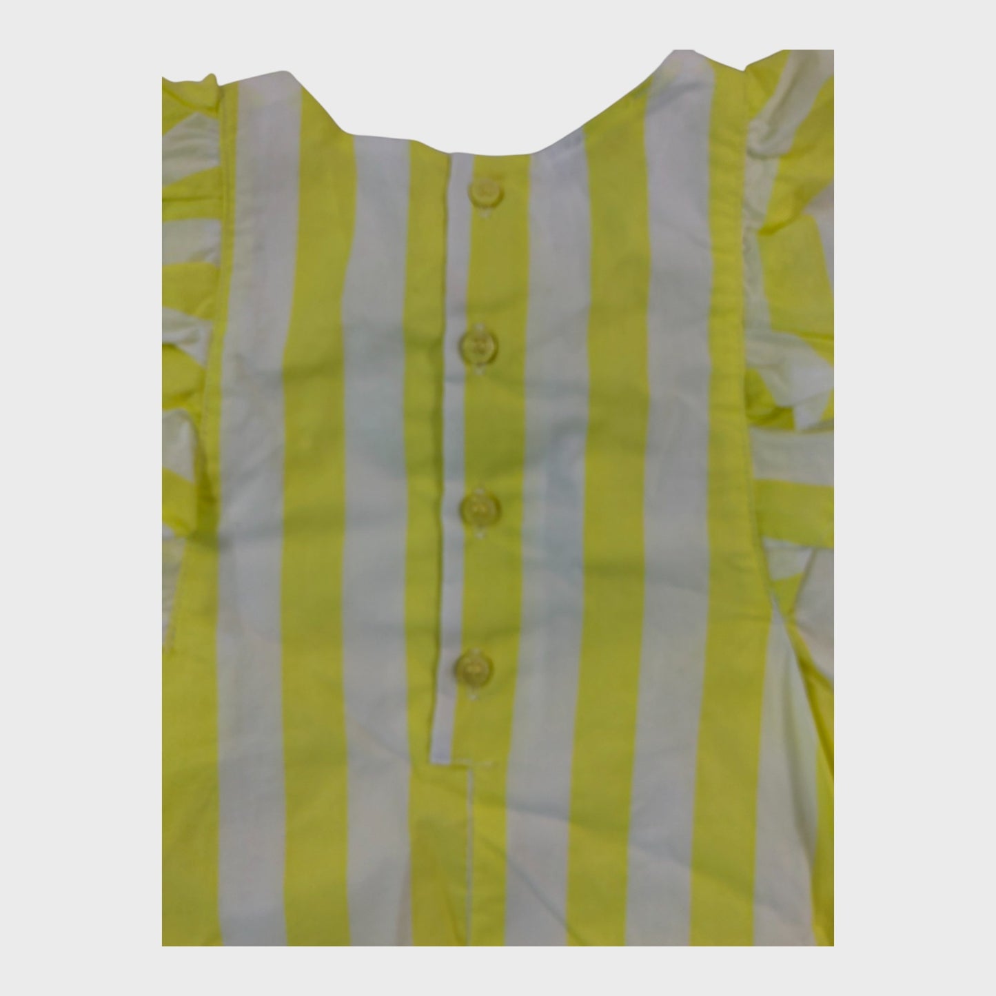 Yellow Striped Summer Dress